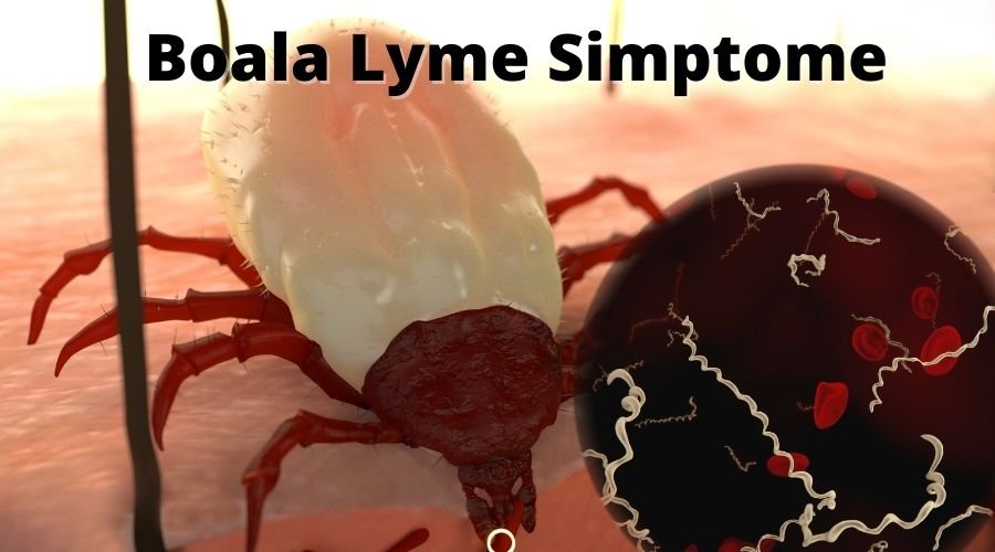 Boala Lyme Simptome: Boala Transmisa de Capuse Infectate cu Bacteria Borellia